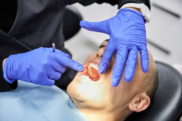 Best Broken or Cracked Tooth Emergency Dentist in Bartonsville, MD