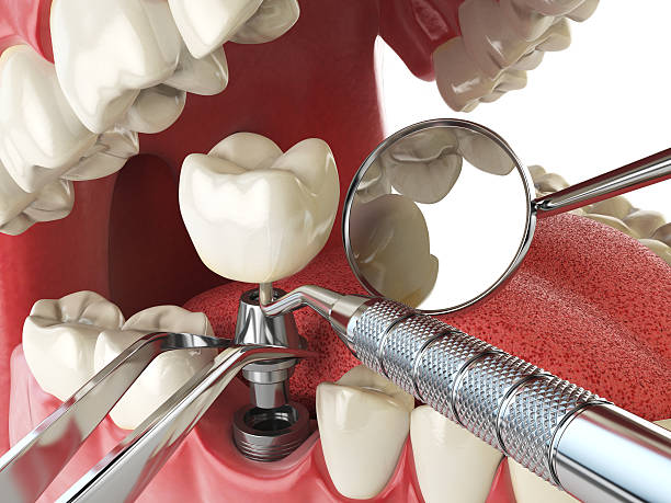 Best 24-Hour Emergency Dentist in Bartonsville, MD